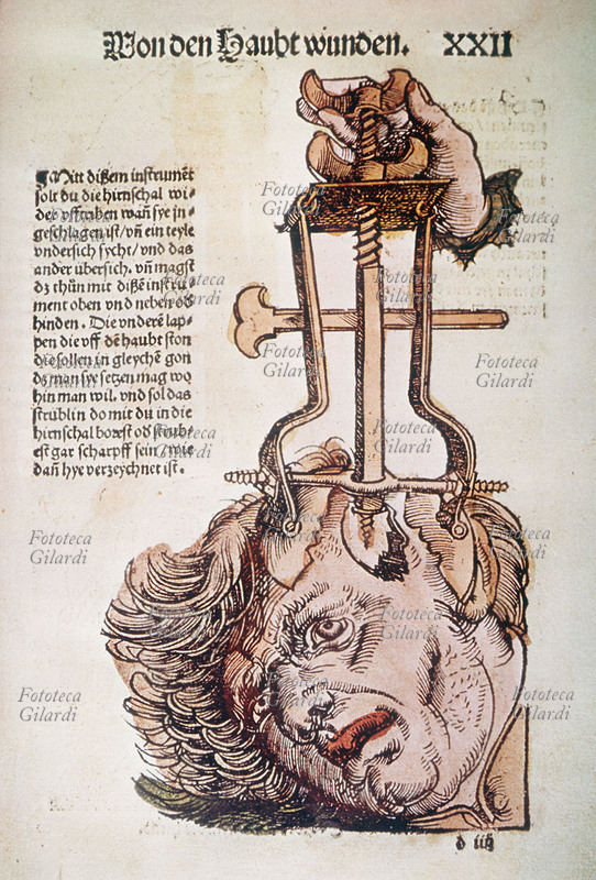 CHIRURGIA Tavola dal trattato di medicina da campo \