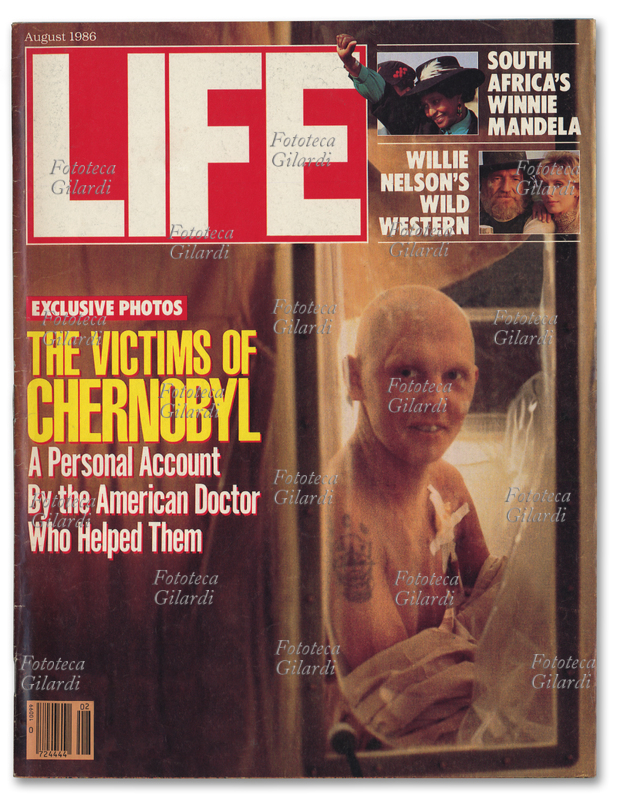 LIFE Exclusive photos: the victims of Chernobyl. A personal account By the American Doctor Who Helped Them; copertina del celebre periodico statunitense, del Agosto 1986.
