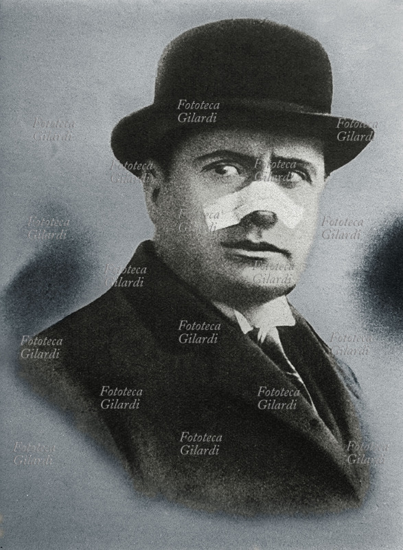 Benito MUSSOLINI (29 luglio 1883 – 28 aprile 1945) esibisce un vistoso cerotto sul naso in seguito all\