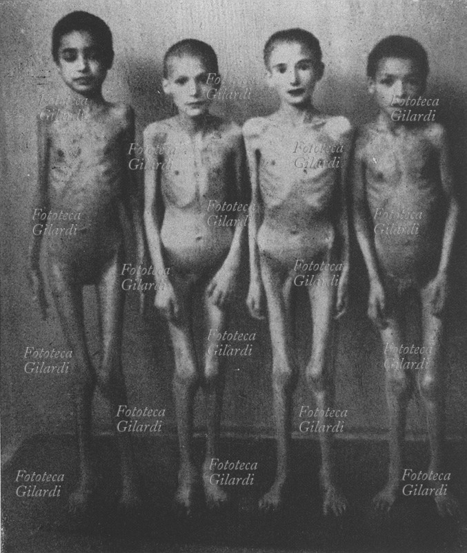 SHOAH Quattro bambine crudelmente deprivate nel campo di concentramento di Auschwitz, scelte per essere usate come cavie in esperimenti scientifici. Fotografia dall\