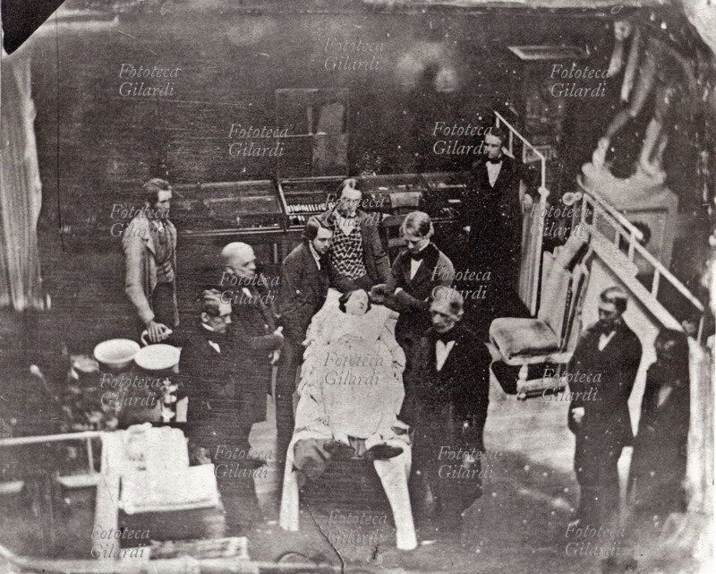 MEDICINA, La seconda operazione effettuata sotto l\