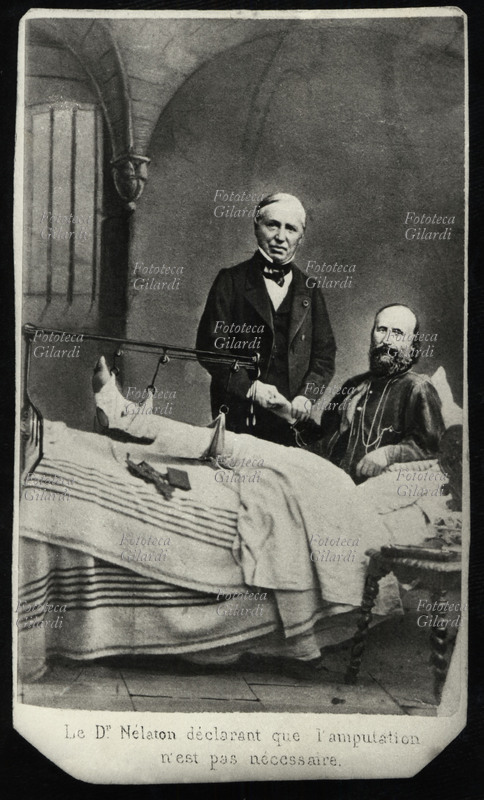 Giuseppe GARIBALDI (1807-1882) ferito ad Aspromonte, con il dottor Nelaton, 1862. (fotomontaggio)