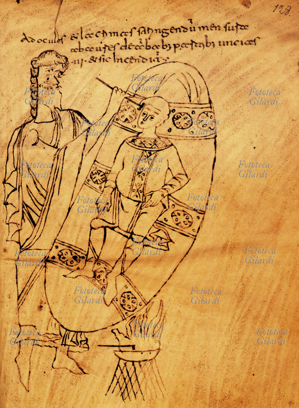 MEDICINA intervento di cauterizzazione. Miniatura da foglio tratto dal manoscritto in latino \