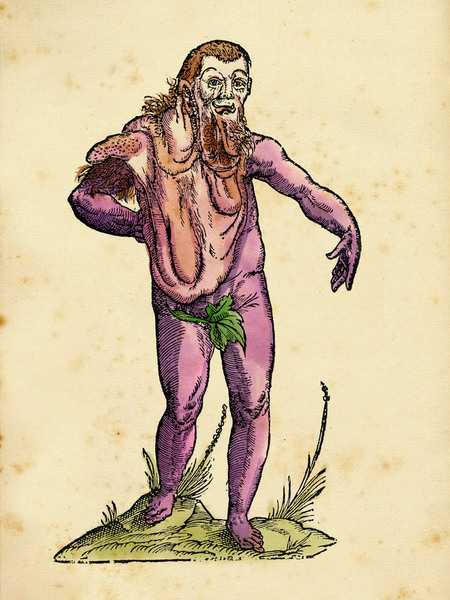 MOSTRO UMANO CON ESCRESCENZA ALDROVANDI MOSTRO UMANO CON ESCRESCENZA ALDROVANDI