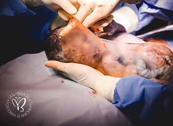 Incredible Photos Of Baby Born In Fluid Filled Bag Incredible Photos Of Baby Born In Fluid Filled Bag