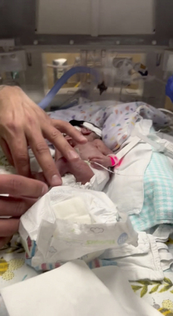 I THOUGHT MY BABY WAS GOING TO DIE WHEN MY WATERS BROKE AT 16 WEEKS