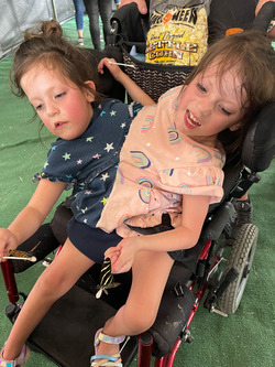 Conjoined Twins Defied Odds By Taking First Step And Living Their Best Life Conjoined Twins Defied Odds By Taking First Step And Living Their Best Life