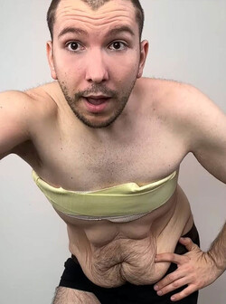 Nikocado Avocado reveals he had 10 lbs. of loose skin removed Nikocado Avocado reveals he had 10 lbs. of loose skin removed