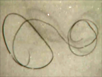 MUM AND HER TWO DAUGHTERS MURDERED BY ANGRY NEPHEW