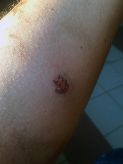 DiCaprio Lookalike Bitten By Suspected Junkie