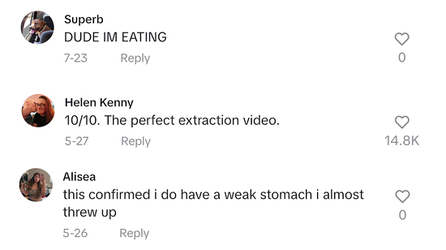 Blackhead removal video equally disgusts and satisfies users