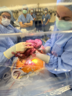 I THOUGHT MY BABY WAS GOING TO DIE WHEN MY WATERS BROKE AT 16 WEEKS