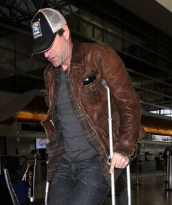Just like us Celebs with injuries and broken bones