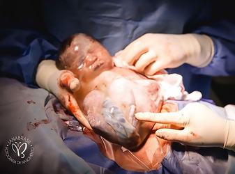 Incredible Photos Of Baby Born In Fluid Filled Bag Incredible Photos Of Baby Born In Fluid Filled Bag