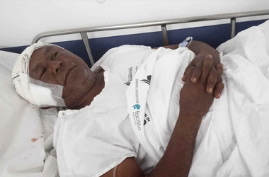 CLAW BLIMEY Horrific Injuries Of Man Who Grappled With Wild Jaguar To Save Nephews