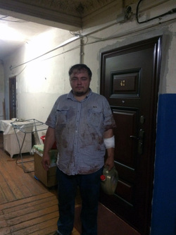 DiCaprio Lookalike Bitten By Suspected Junkie