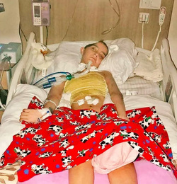 Motorcyclist Fighting For Life After Losing Half Her Head in Crash