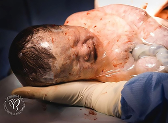 Incredible Photos Of Baby Born In Fluid Filled Bag Incredible Photos Of Baby Born In Fluid Filled Bag