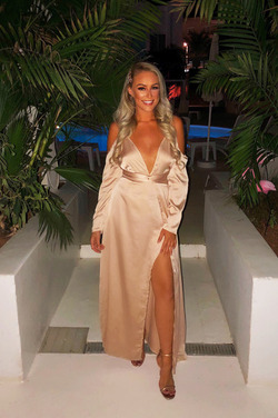 AIR HOSTESS COMPARED TO BURNS VICTIM AFTER SEVERE PSORIASIS FLARE UP SHOWCASES CLEAR SKIN AFTER SWITCHING DIET