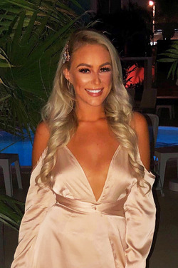 AIR HOSTESS COMPARED TO BURNS VICTIM AFTER SEVERE PSORIASIS FLARE UP SHOWCASES CLEAR SKIN AFTER SWITCHING DIET