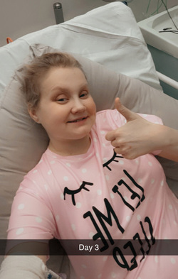 WALKING FOR THE FIRST TIME SINCE BECOMING A DOUBLE AMPUTEE