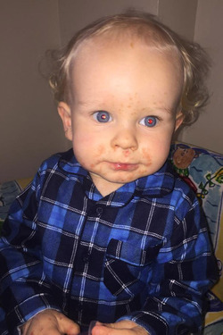 MOTHER SPEAKS OUT AFTER HER SON CONTRACTED THE HERPES VIRUS THROUGH A KISS