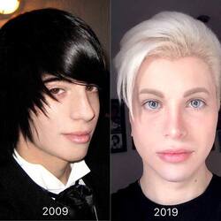  I m a real life ELF and have spent &pound;61 000 on my body transformation including eye colour change and skin whitening 