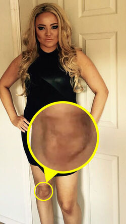 Things that look like Donald Trump