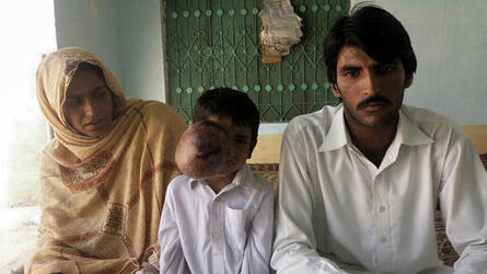 PAKISTANI PARENTS JOY AFTER BOXER AMIR KHAN COMES FOR HELP TO THEIR SEVEN YEAR OLD SON WITH ENORMOUS TUMOUR