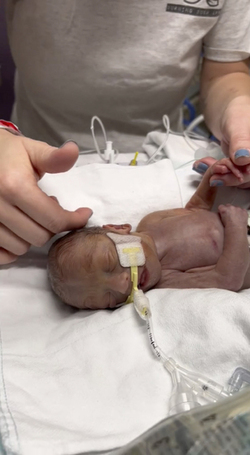 I THOUGHT MY BABY WAS GOING TO DIE WHEN MY WATERS BROKE AT 16 WEEKS