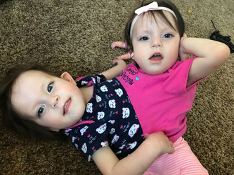 Conjoined Twins Defied Odds By Taking First Step And Living Their Best Life Conjoined Twins Defied Odds By Taking First Step And Living Their Best Life