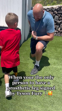 Tyson Fury Signed My Prosthetic Leg Tyson Fury Signed My Prosthetic Leg