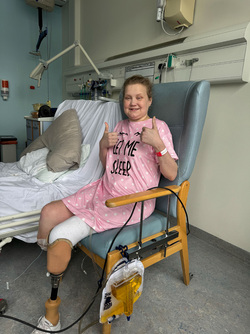 WALKING FOR THE FIRST TIME SINCE BECOMING A DOUBLE AMPUTEE