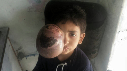 PAKISTANI PARENTS JOY AFTER BOXER AMIR KHAN COMES FOR HELP TO THEIR SEVEN YEAR OLD SON WITH ENORMOUS TUMOUR