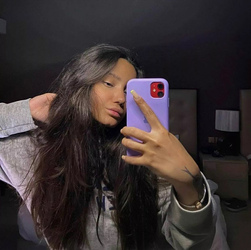 Motorcyclist Fighting For Life After Losing Half Her Head in Crash