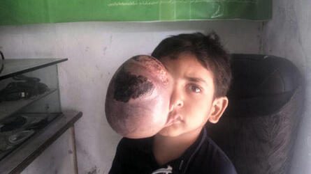 PAKISTANI PARENTS JOY AFTER BOXER AMIR KHAN COMES FOR HELP TO THEIR SEVEN YEAR OLD SON WITH ENORMOUS TUMOUR