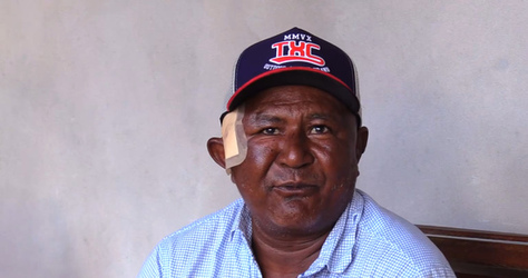 CLAW BLIMEY Horrific Injuries Of Man Who Grappled With Wild Jaguar To Save Nephews