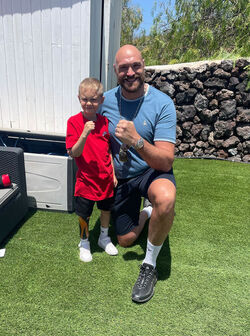 Tyson Fury Signed My Prosthetic Leg Tyson Fury Signed My Prosthetic Leg