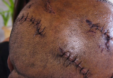 CLAW BLIMEY Horrific Injuries Of Man Who Grappled With Wild Jaguar To Save Nephews