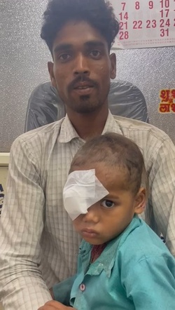 Boy three has WORM removed from his eye after it crawled inside Boy three has WORM removed from his eye after it crawled inside