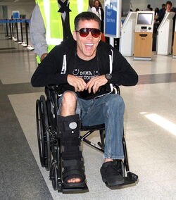 Just like us Celebs with injuries and broken bones