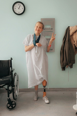 WALKING FOR THE FIRST TIME SINCE BECOMING A DOUBLE AMPUTEE