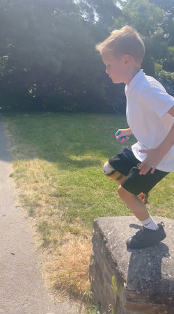 Tyson Fury Signed My Prosthetic Leg Tyson Fury Signed My Prosthetic Leg