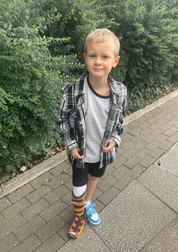 Tyson Fury Signed My Prosthetic Leg Tyson Fury Signed My Prosthetic Leg