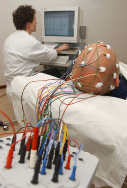 Epilessia