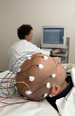 Epilessia