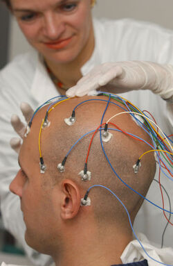 Epilessia