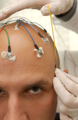 Epilessia